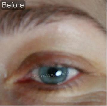 Eye Liner - Before