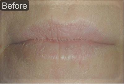 Lips - Before