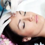 Vacuum Therapy Facial