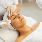 Radio Frequency Eye Lift