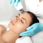 Ultraljudspeeling