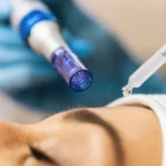 Derma Pen