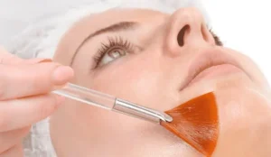 Sensitive peeling