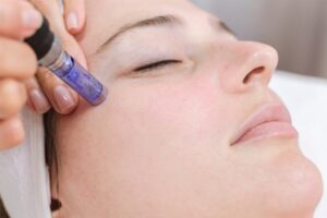 derma-pen-nano-veropigment25