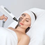 Hollywood-behandling (Carbon Laser Peel)